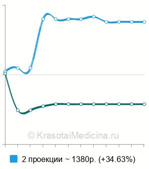Средняя стоимость рентген предплечья в Волгограде
