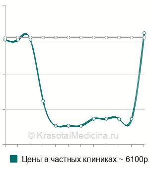 Средняя стоимость ангиография головного мозга в Волгограде