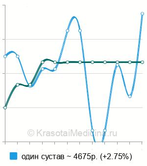 Средняя стоимость МРТ тазобедренного сустава в Волгограде