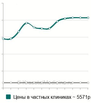 Средняя стоимость эхогистеросальпингоскопия (УЗГСС) в Волгограде